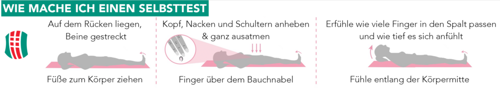 Einfacher Rektusdiastase Selbsttest